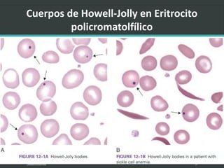 LATRODECTUS MACTANS 17
 