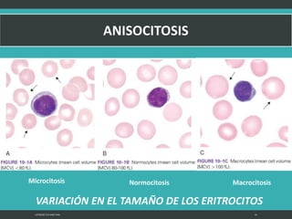 LATRODECTUS MACTANS 19
Microcitosis MacrocitosisNormocitosis
VARIACIÓN EN EL TAMAÑO DE LOS ERITROCITOS
 