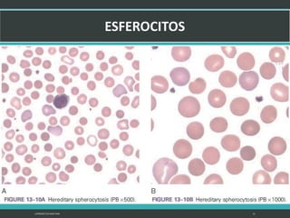 LATRODECTUS MACTANS 21
 