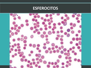 LATRODECTUS MACTANS 22
 