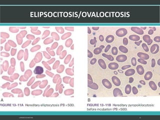 LATRODECTUS MACTANS 23
 