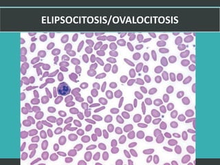 LATRODECTUS MACTANS 25
 