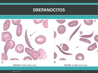 LATRODECTUS MACTANS 26
 