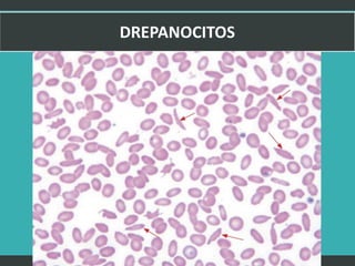 LATRODECTUS MACTANS 27
 