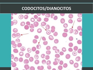 LATRODECTUS MACTANS 28
 
