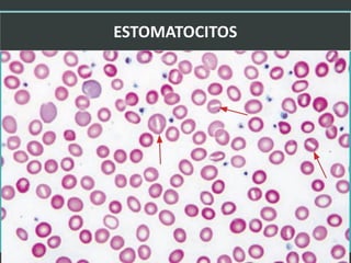 LATRODECTUS MACTANS 31
 