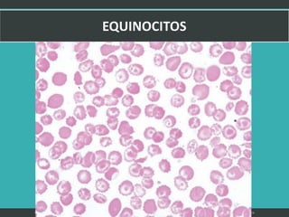 LATRODECTUS MACTANS 32
 