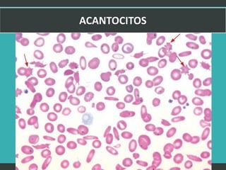 LATRODECTUS MACTANS 33
 