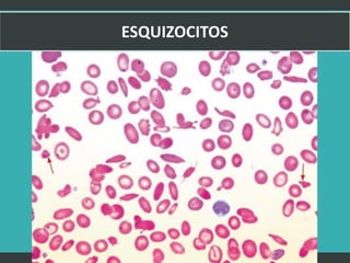 LATRODECTUS MACTANS 34
 