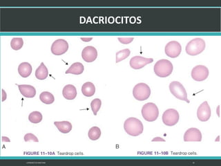 LATRODECTUS MACTANS 35
 