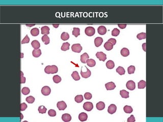 LATRODECTUS MACTANS 36
 