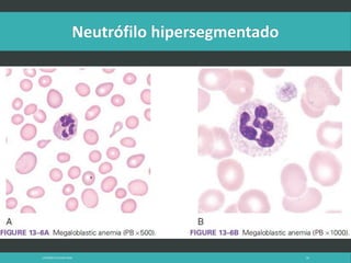 LATRODECTUS MACTANS 58
 