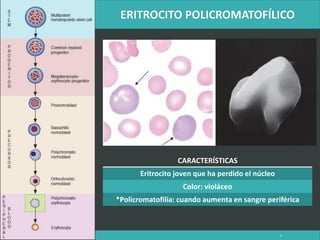 LATRODECTUS MACTANS 8
CARACTERÍSTICAS
Eritrocito joven que ha perdido el núcleo
Color: violáceo
*Policromatofilia: cuando aumenta en sangre periférica
 