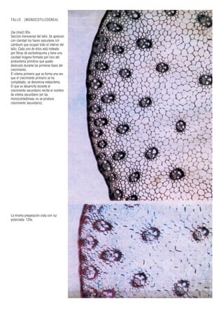 TALLO (MONOCOTILEDONEA)
Zea (maíz) 80x.
Sección transversal del tallo. Se aprecian
con claridad los haces vasculares sin
cambium que ocupan todo el interior del
tallo. Cada uno de ellos está rodeado
por fibras de esclerénquima y tiene una
cavidad lisígena formada por lisis del
protoxilema primitivo que queda
destruido durante las primeras fases del
crecimiento.
El xilema primario que se forma una vez
que el crecimiento primario se ha
completado, se denomina metaxilema.
El que se desarrolla durante el
crecimiento secundario recibe el nombre
de xilema secundario (en las
monocotiledóneas no se produce
crecimiento secundario).
La misma preparación vista con luz
polarizada. 120x.
 