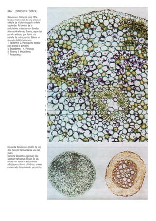 RAIZ (DINOCOTILEDONEA)
Ranunculus (botón de oro) 180x.
Sección transversal de una raíz joven
(detalle de la fotomicrografía inferior
izquierda). Por dentro de la
endodermis se encuentran bandas
alternas de xilema y floema, separadas
por el cambium, que forma una
estrella de cuatro puntas. Este es un
ejemplo de tallo tetrámero.
1. Epidermis; 2. Parénquima cortical
con granos de almidón;
3. Endodermis; 4. Periciclo;
5. Floema; 6. Metaxilema;
7. Protoxilema.
1
2
3
4
5
6
7
Izquierda: Ranunculus (botón de oro)
45x. Sección transversal de una raíz
joven.
Derecha: Helianthus (girasol) 60x.
Sección transversal de raíz. En las
raíces más maduras el cambium
adopta un contorno cilíndrico, una vez
comenzado el crecimiento secundario.
 