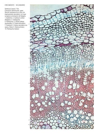 CRECIMIENTO SECUNDARIO
Sambucus (sauco) 110x.
Coloración safranina-fast green.
Sección transversal de un tallo con
engrosamiento secundario, en la que
se aprecia la formación del felógeno.
1. Epidermis; 2. Cambium cortical
(felógeno); 3. Colénquima;
4. Parénquima; 5. Células pétreas
(esclereidas); 6. Floema secundario;
7. Cambium; 8. Xilema secundario con
vasos y fibras; 9. Xilema primario;
10. Parénquima medular.
1
2
3
4
5
6
7
8
9
10
 