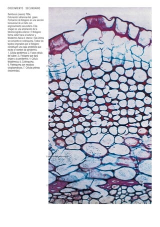 CRECIMIENTO SECUNDARIO
Sambucus (sauco) 700x.
Coloración safranina-fast green.
Formación de felógeno en una sección
transversal de un tallo con
engrosamiento secundario. Esta
imagen es una ampliación de la
fotomicrografía anterior. El felógeno
forma súber hacia el exterior y
felodermis hacia el interior. Esta última
se convierte en colénquima. Todos los
tejidos originados por el felógeno
constituyen una capa protectora que
recibe el nombre de peridermis.
1. Célula epidérmica; 2. Futura célula
del súber; 3.; Felógeno que dará
origen a la peridermis; 4. Célula
felodérmica; 5. Colénquima;
6. Parénquima con residuos
citoplasmáticos; 7. Células pétreas
(esclereidas).
1
2
3
4
5
6
7
 