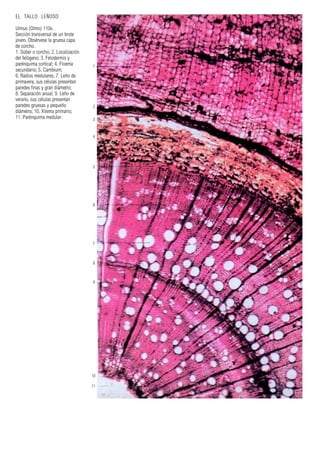 1
2
3
4
5
6
7
8
9
10
11
EL TALLO LEÑOSO
Ulmus (Olmo) 110x.
Sección transversal de un brote
joven. Obsérvese la gruesa capa
de corcho.
1. Súber o corcho; 2. Localización
del felógeno; 3. Felodermis y
parénquima cortical; 4. Floema
secundario; 5. Cambium;
6. Radios medulares; 7. Leño de
primavera, sus células presentan
paredes finas y gran diámetro;
8. Separación anual; 9. Leño de
verano, sus células presentan
paredes gruesas y pequeño
diámetro; 10. Xilema primario;
11. Parénquima medular.
 