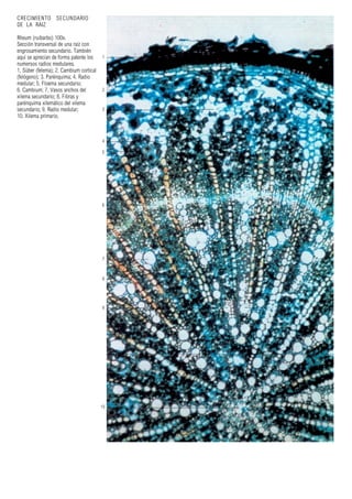 1
2
3
4
5
6
7
8
9
10
CRECIMIENTO SECUNDARIO
DE LA RAIZ
Rheum (ruibarbo) 100x.
Sección transversal de una raíz con
engrosamiento secundario. También
aquí se aprecian de forma patente los
numersos radios medulares.
1. Súber (felema); 2. Cambium cortical
(felógeno); 3. Parénquima; 4. Radio
medular; 5. Floema secundario;
6. Cambium; 7. Vasos anchos del
xilema secundario; 8. Fibras y
parénquima xilemático del xilema
secundario; 9. Radio medular;
10. Xilema primario.
 