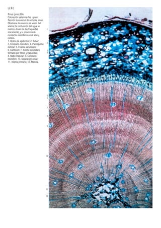 1
2
3
4
5
6
7
8
9
10
11
12
LEÑO
Pinus (pino) 80x.
Coloración safranina-fast green.
Sección transversal de un brote joven.
Obsérvese la ausencia de vasos del
xilema (la conducción del agua se
realiza a través de las traqueidas
únicamente) y la presencia de
conductos resiníferos en el leño y
corteza.
1. Restos de epidermis; 2. Súber;
3. Conducto resinífero; 4. Parénquima
cortical; 5. Floema secundario;
6. Cambium; 7. Xilema secundario
formado por fibras y traqueidas;
8. Radio medular; 9. Conducto
resinífero; 10. Separación anual;
11. Xilema primario; 12. Médula.
 