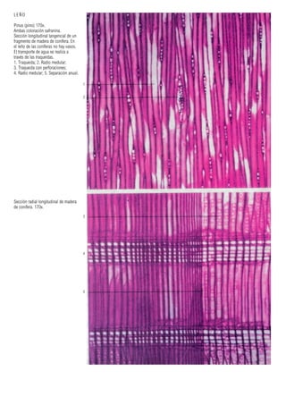 1
2
3
4
5
LEÑO
Pinus (pino) 170x.
Ambas coloración safranina.
Sección longitudinal tangencial de un
fragmento de madera de conífera. En
el leño de las coníferas no hay vasos.
El transporte de agua se realiza a
través de las traqueidas.
1. Traqueida; 2. Radio medular;
3. Traqueida con perforaciones;
4. Radio medular; 5. Separación anual.
Sección radial longitudinal de madera
de conífera. 170x.
 