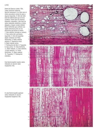 1
2
3
4
5
6
7
8
9
10
11
12
14
13
15
16
17
LEÑO
Xilema de Quercus (roble) 130x.
Todas coloración safranina.
Sección transversal. En el leño duro el
xilema secundario consta de vasos y
algunas traqueidas. El leño del roble
está más diferenciado que el de las
coníferas. Posee vasos de diversos
diámetros, traqueidas, y dos tipos de
radios medulares (estrechos y cortos,
delgados y largos); existen también
fibras libriformes que confieren una
rigidez estructural junto con las
estructuras que forman el xilema.
1. Vaso estrecho (formado en verano);
2. Vaso ancho (de la primavera
siguiente); 3. Zona de traqueidas
(tejido conductor con fibras
libriformes); 4. Radio medular
estrecho; 5. Separación anual;
6. Radio medular ancho;
7. Parénquima del leño; 8. Traqueida;
9. Vaso ancho; 10. Fibra libriforme;
11. Radio medular; 12. Vaso estrecho;
13.Vaso estrecho; 14. Fibras
libriformes; 15. Radio medular;
16. Traqueida; 17. Parénquima
xilemático.
Esta fotomicrografía muestra radios
medulares en sección radial
longitudinal. 85x.
En esta fotomicrografía aparecen
radios medulares en sección
longitudinal tangencial. 85x.
 