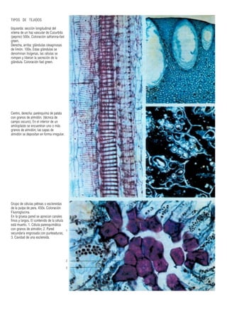 TIPOS DE TEJIDOS
Izquierda: sección longitudinal del
xilema de un haz vascular de Cucurbita
(pepino) 500x. Coloración safranina-fast
green.
Derecha, arriba: glándulas oleaginosas
de limón. 100x. Estas glándulas se
denominan lisígenas, las células se
rompen y liberan la secreción de la
glándula. Coloración fast green.
Centro, derecha: parénquima de patata
con granos de almidón. (técnica de
campo oscuro). En el interior de un
amiloplasto se encuentran uno o más
granos de almidón; las capas de
almidón se depositan en forma irregular.
Grupo de células pétreas o esclereidas
de la pulpa de pera. 450x. Coloración
Fluoroglucina.
En la gruesa pared se aprecian canales
finos y largos. El contenido de la célula
está muerto. 1. Célula parenquimática
con granos de almidón; 2. Pared
secundaria engrosada con punteaduras;
3. Cavidad de una esclereida.
1
2
3
 