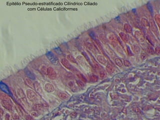 Epitélio Pseudo-estratificado Cilíndrico Ciliado
com Células Caliciformes
 