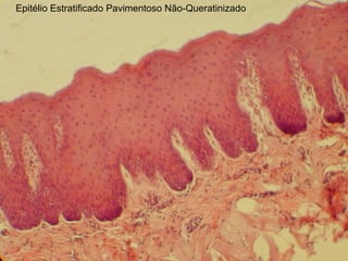 Epitélio Estratificado Pavimentoso Não-Queratinizado
 
