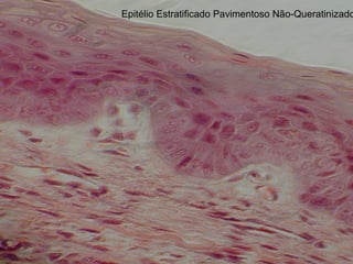 Epitélio Estratificado Pavimentoso Não-Queratinizado
 