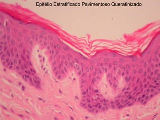 Epitélio Estratificado Pavimentoso Queratinizado
 
