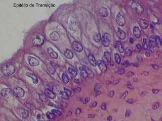 Epitélio de Transição
 