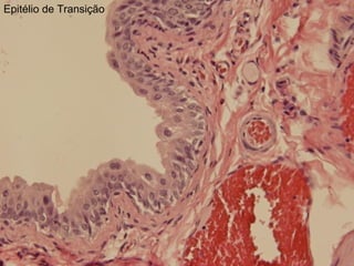 Epitélio de Transição
 