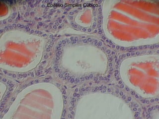 Epitélio Simples Cúbico
 