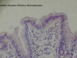 Epitélio Simples Cilíndrico Mucossecretor
 