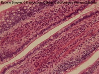 Epitélio Simples Cilíndrico com Células Caliciformes e Planura Estriada
 