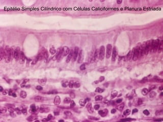 Epitélio Simples Cilíndrico com Células Caliciformes e Planura Estriada
 