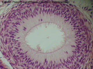 Epitélio Pseudo-estratificado Cilíndrico Estereociliado
 