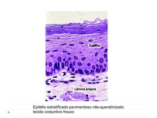 Epitélio estratificado pavimentoso não-queratinizado
tecido conjuntivo frouxo
 