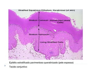 Epitélio estratificado pavimentoso queratinizado (pele espessa)
Tecido conjuntivo
 