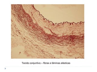 Tecido conjuntivo – fibras e lâminas elásticas
 