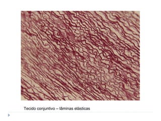Tecido conjuntivo – lâminas elásticas
 