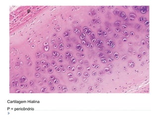 Cartilagem Hialina
P = pericôndrio
 
