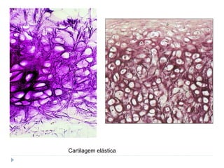 Cartilagem elástica
 