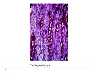 Cartilagem fibrosa
 