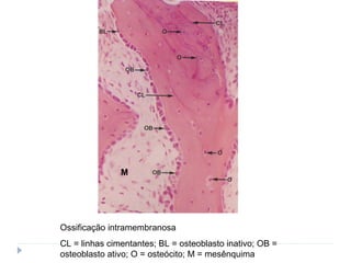 Ossificação intramembranosa
CL = linhas cimentantes; BL = osteoblasto inativo; OB =
osteoblasto ativo; O = osteócito; M = mesênquima
M
 