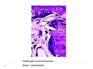 Ossificação intramembranosa
Setas = osteoclastos
 