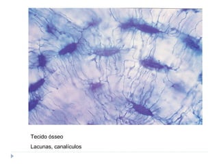 Tecido ósseo
Lacunas, canalículos
 