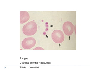 Sangue
Cabeças de seta = plaquetas
Setas = hemácias
 
