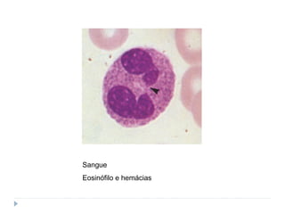 Sangue
Eosinófilo e hemácias
 
